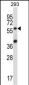 SOCS6 Antibody (N-term)